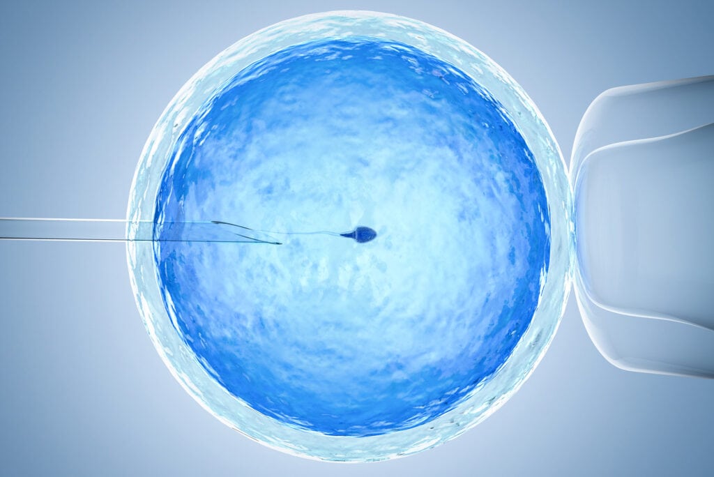 IVF
