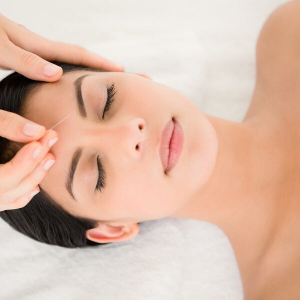 Acupuncture and Menopause